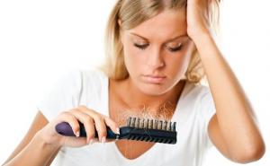 Alopecia femenina: causas, tratamientos y soluciones