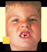 bebe2