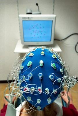 El electroencefalograma