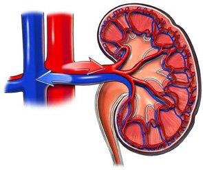 Insuficiencia renal: clínica y tratamiento