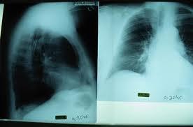 radiografia